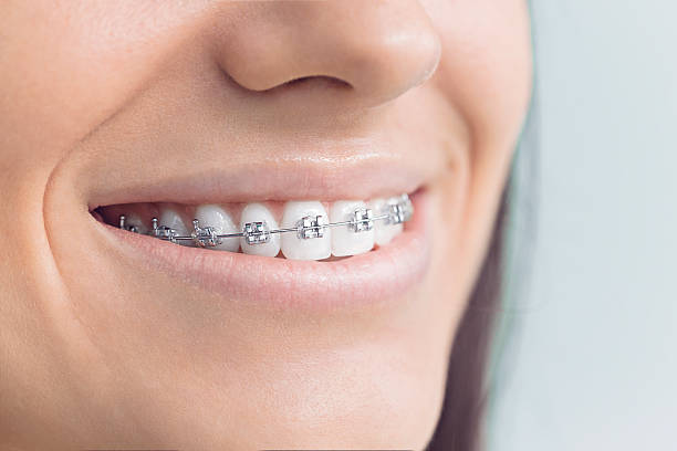 Best Veneers and Lumineers  in South Valley Stream, NY